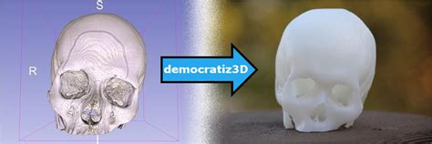 democratiz3d|democratiz3D Converts Medical Scans to 3D Printable Files.